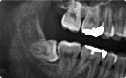 口腔外科：口の中のトラブルに小手術を行います